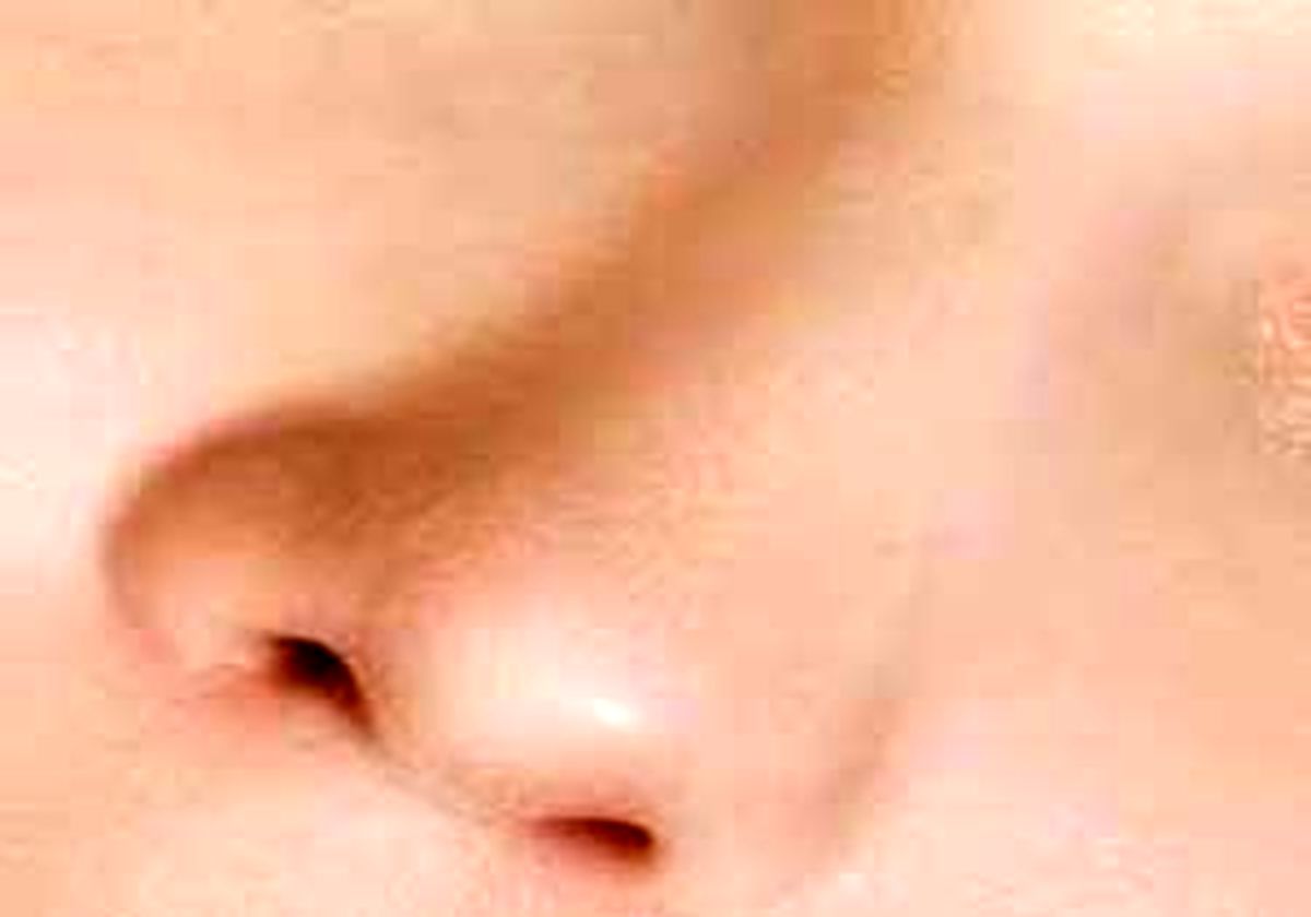 سـودای بینی نقلی!