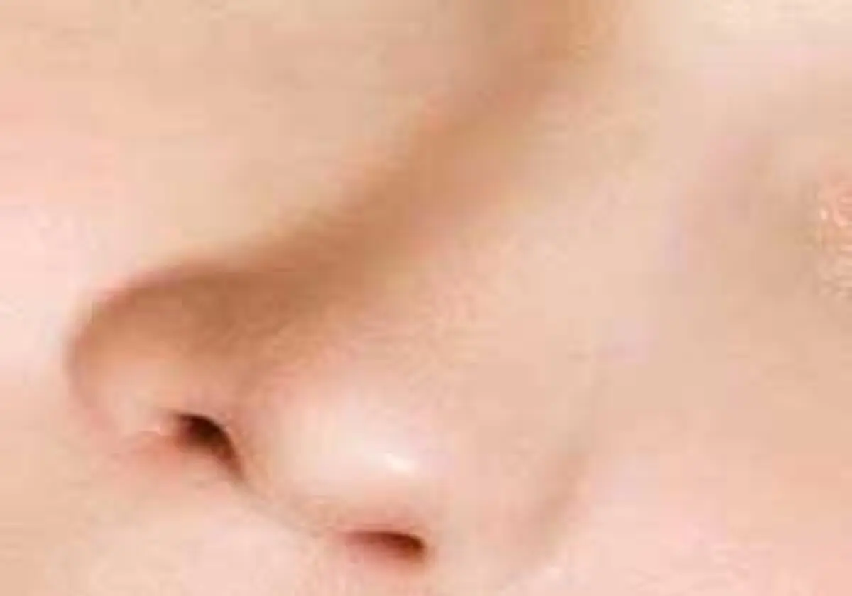 سـودای بینی نقلی!