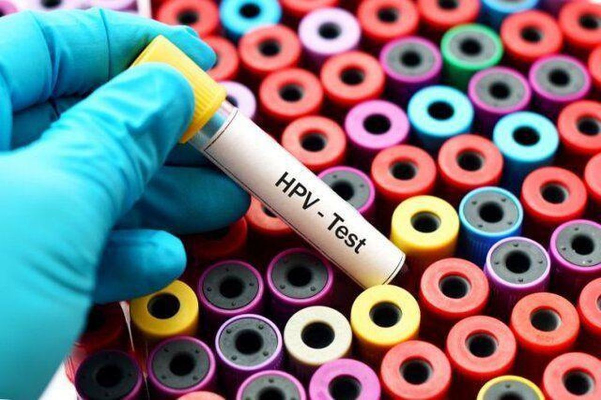 نرخ ۵ تا ۹ درصدی ابتلا به HPV در کشور / ۳۰ هزار نفر به خاطر آلودگی هوا زودتر فوت می‌کنند