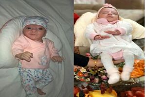 تصاویر نوزاد نیم کیلویی در قم که با مراقبت ویژه به ۳ کیلو رسید