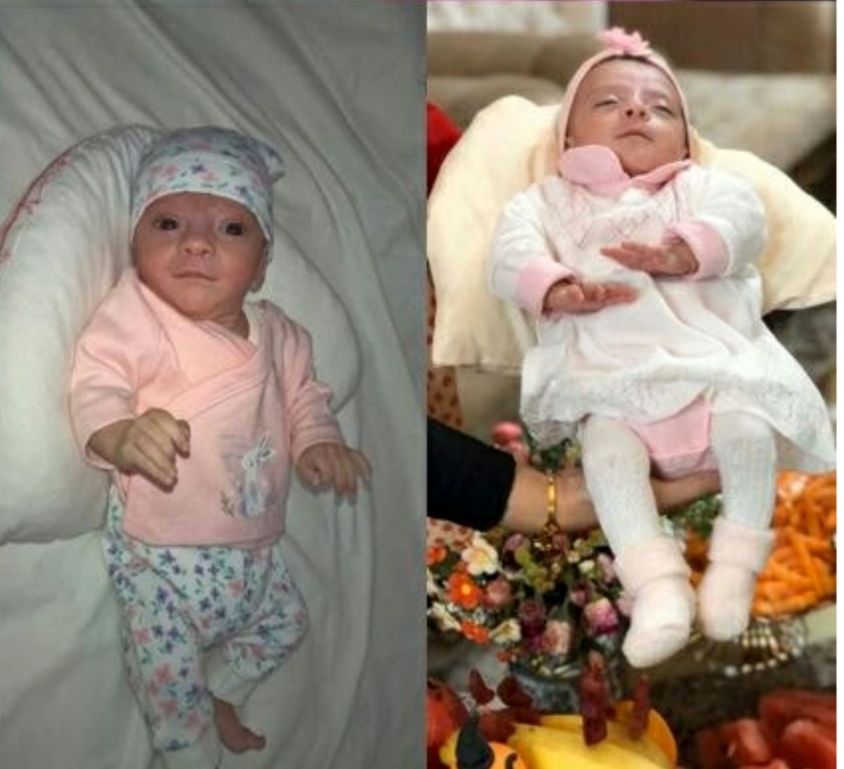 تصاویر نوزاد نیم کیلویی در قم که با مراقبت ویژه به ۳ کیلو رسید