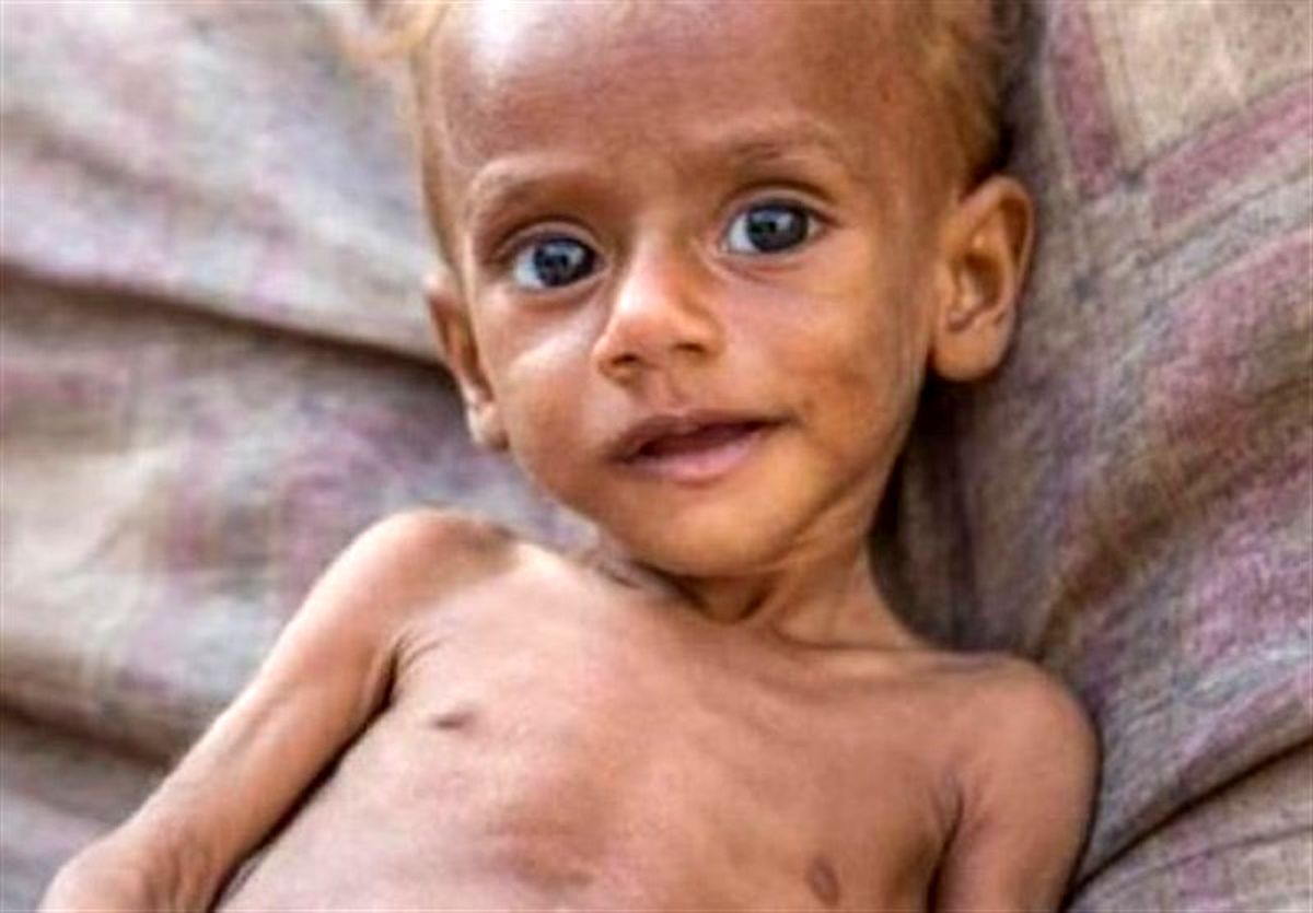 ۱۱ میلیون کودک در آمریکا با گرسنگی روبرو هستند
