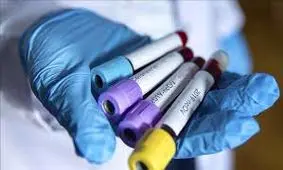 چرا مردان بیشتر از زنان به کرونا مبتلا می‌شوند؟