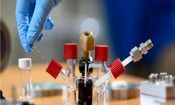 هواپیماهای برقی می‌توانند دی اکسید کربن آسمان را بمکند

