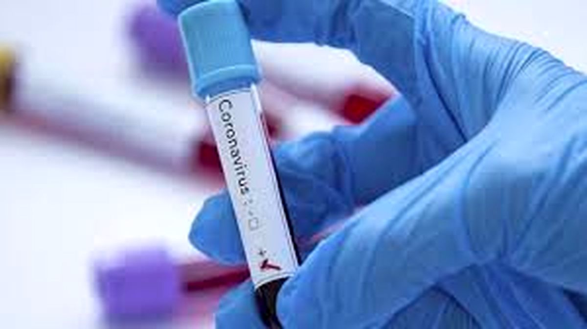 کروناویروس از طریق رابطه جنسی منتقل میشود؟