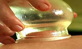 نیمار برای درمان به طب سنتی روی آورد