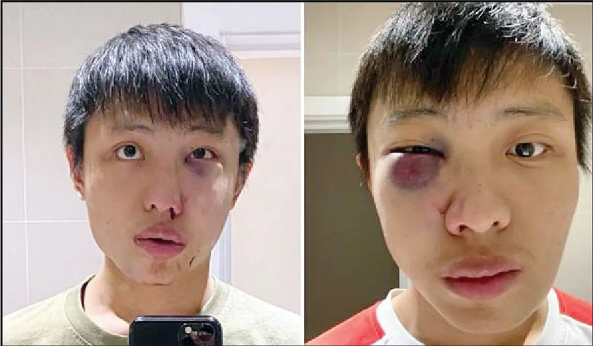 ضرب و شتم به جرم چشم‌بادامی بودن