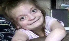 قتل دختر معلول توسط مادر