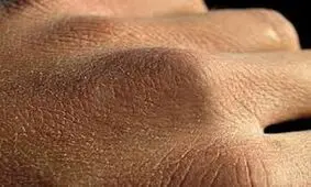 راههای مقابله با خشکی پوست دست در روزهای کرونایی