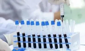 دومین بیمار «اچ آی وی» به طور کامل بهبود پیدا کرد