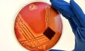 کشف آنتی‌بیوتیک‌های بسیار قوی با استفاده از هوش مصنوعی