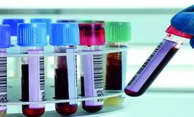 اینفوگرافی| آمار کرونا در ایران طی ۲۴ ساعت - ۱۱ تا ۱۲ اسفند