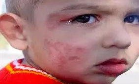 رقابت کرونا با سالک در چابهار ‏