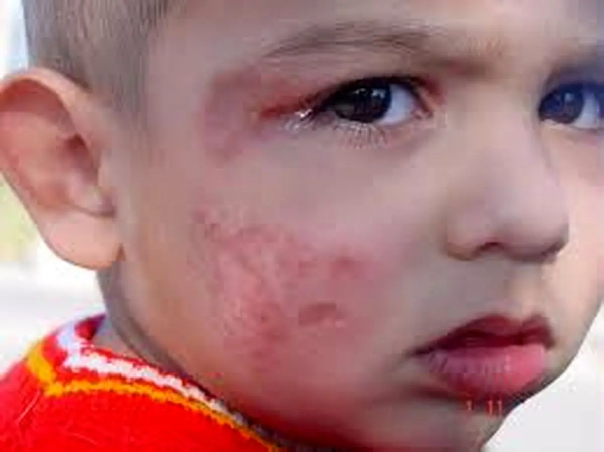 رقابت کرونا با سالک در چابهار ‏