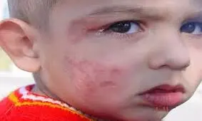 رقابت کرونا با سالک در چابهار ‏