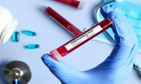 کرونا به روایت آمارهای جهانی