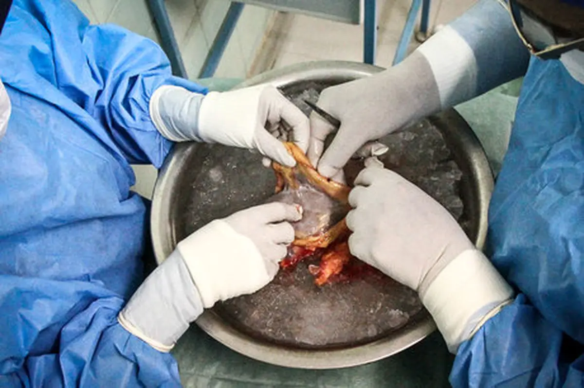 اهدای عضو، هدیه کودک 5 ساله به هم‌نوعان خود