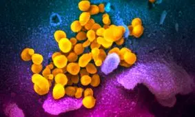 اینفوگرافی| تفاوت‌های کرونا، آلرژی و آنفلوآنزا در یک نگاه