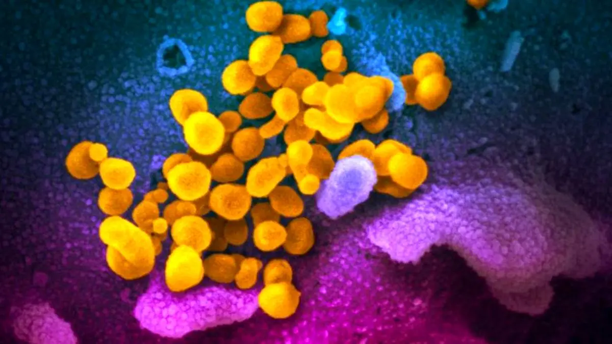 اینفوگرافی| تفاوت‌های کرونا، آلرژی و آنفلوآنزا در یک نگاه