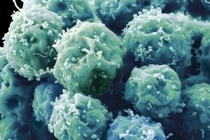 سلول‌های بنیادی ممکن است سرطان‌زا باشند!