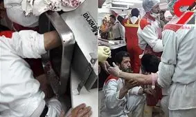 چرخ‌گوشت دست پسر جوان را بلعید