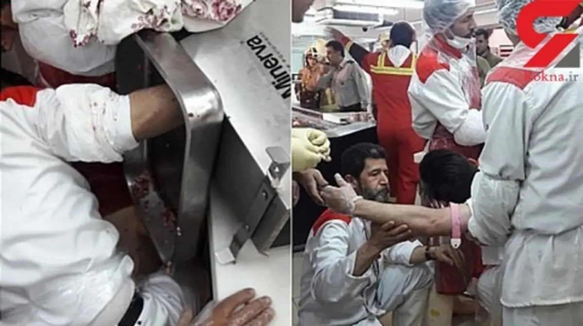 چرخ‌گوشت دست پسر جوان را بلعید