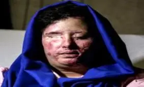 برای جراحی چشم به آمریکا آمدم