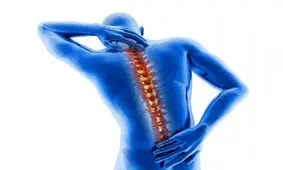 اختلال عضلانی اسکلتی؛ کودکان ایرانی را نشانه گرفته است