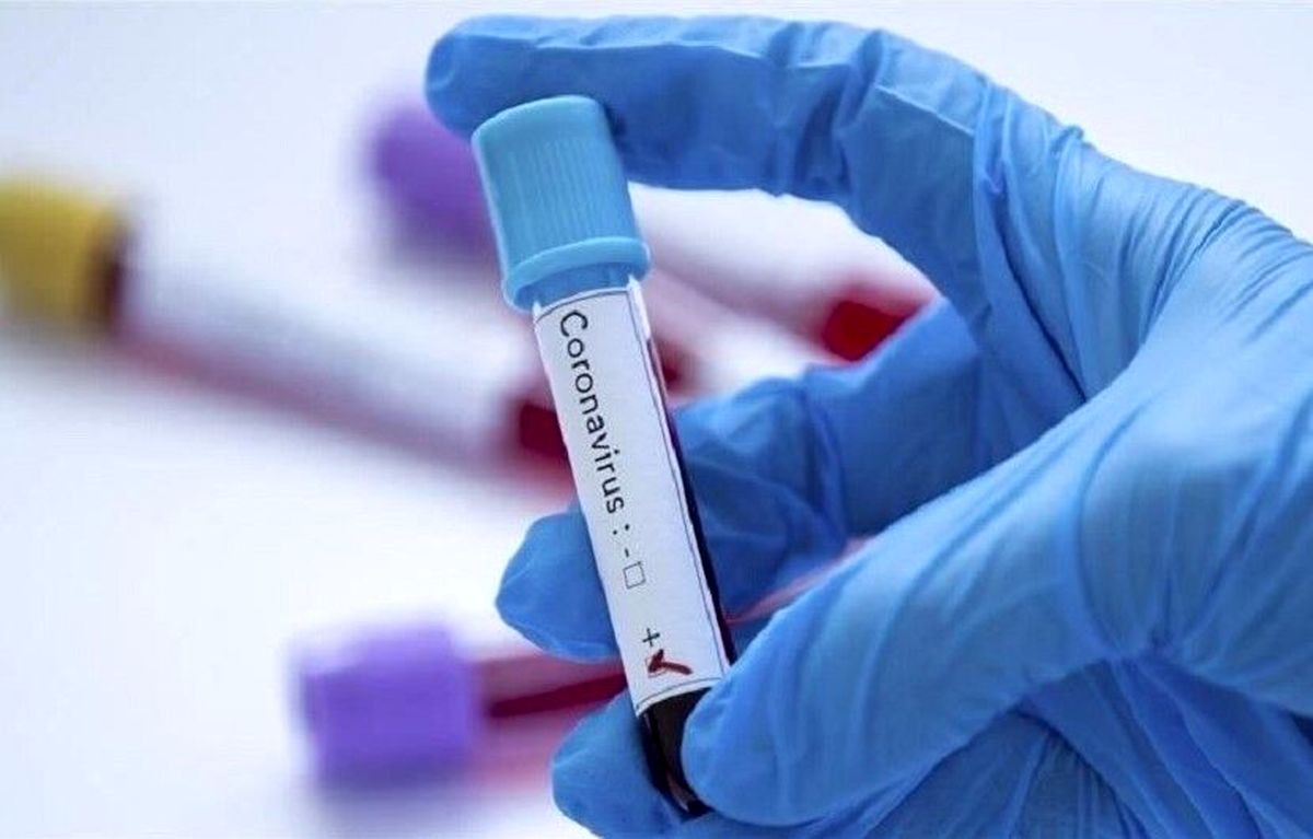 مراکز آزمایشگاهی تشخیص کرونا در مشهد افزایش یافت