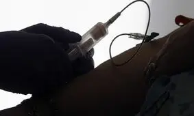 شیوه جدید آزمایش خون ۵۰ گونه سرطانی را شناسایی می‌کند 