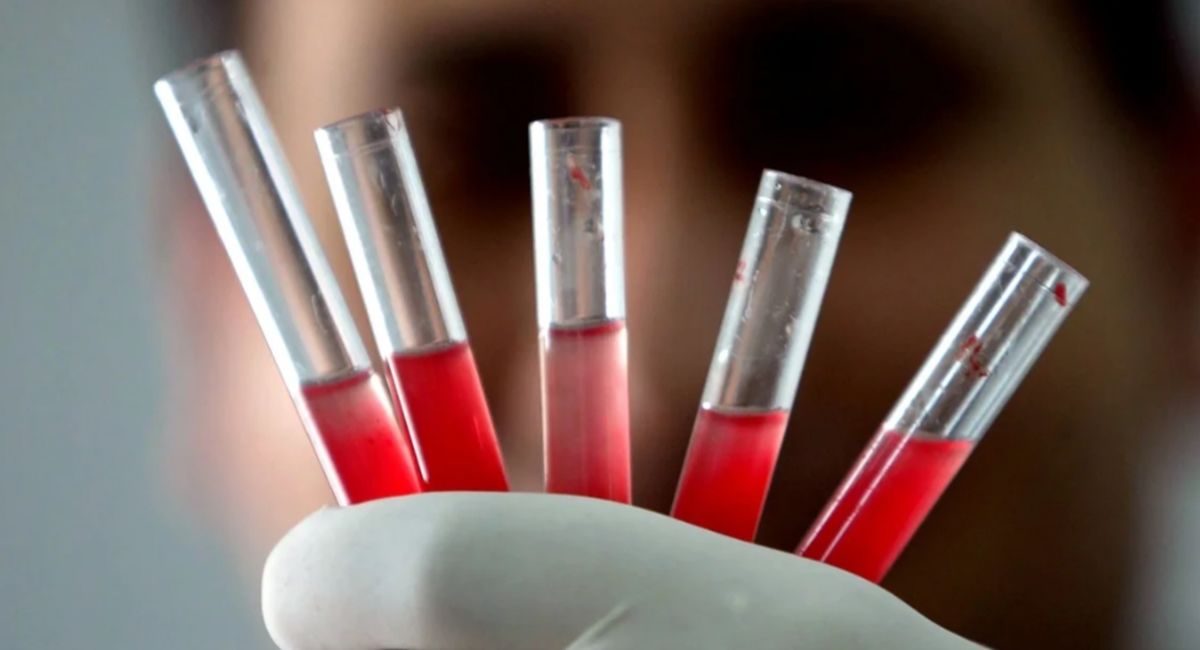 گران‌ترین خون روی زمین را بشناسید / خونی که محققان در سراسر کره زمین تنها ۴۳ مورد از آن را شناسایی کرده‌اند