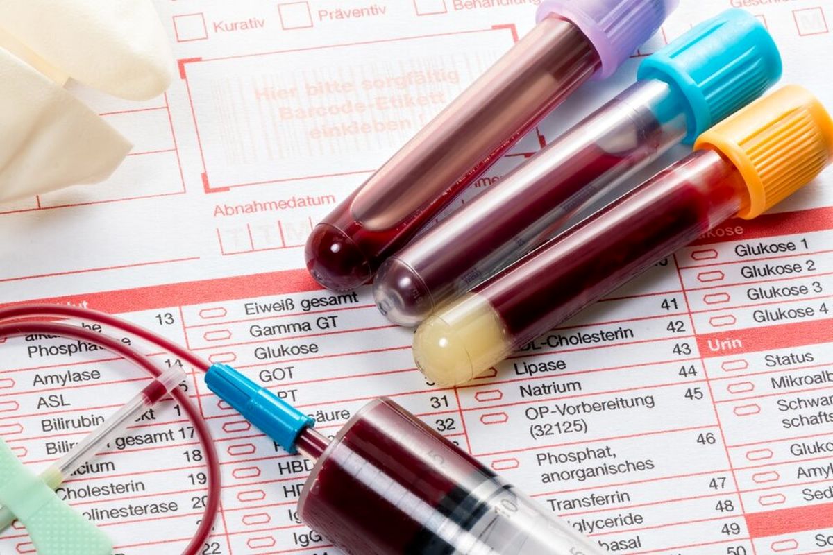 آزمایش خونی که می تواند &#039;بیش از ۵۰ نوع سرطان را شناسایی کند&#039;