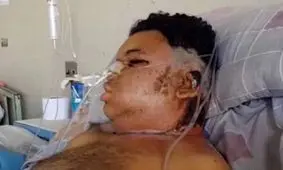 بلای که عقرب سر این مرد جوان آورد+ عکس