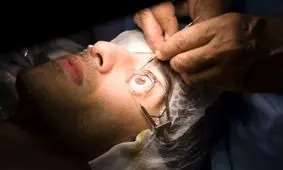 آزمایش موفقیت‌آمیز شبکیه چشم مصنوعی حاوی الکترودهای نانومقیاس