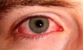 کرونا هیچ آسیبی به «بینایی» نمی‌زند