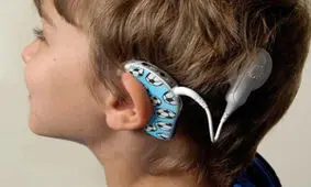 موثرترین زمان برا کاشت حلزون در کودکان ناشنوا