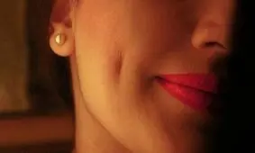 فیلم / عمل زیبایی چال گذاشتن روی لپ