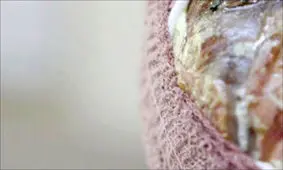 چشم در برابر چشم! / حدقه چشمان بماند ولی تمام بینایی قصاص شود