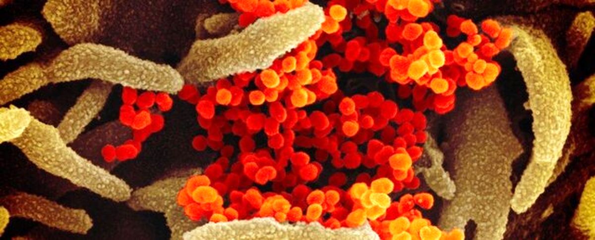 آسیب‌پذیرترین سلول‌های انسان در مقابل کروناویروس شناسایی شدند