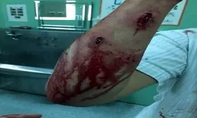 انفجار دستگاهی در آزمایشگاه 6 دانشجو را مجروح کرد/ یک نفر تحت عمل جراحی قرار گرفت