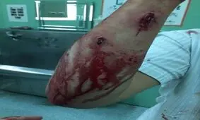 انفجار دستگاهی در آزمایشگاه 6 دانشجو را مجروح کرد/ یک نفر تحت عمل جراحی قرار گرفت