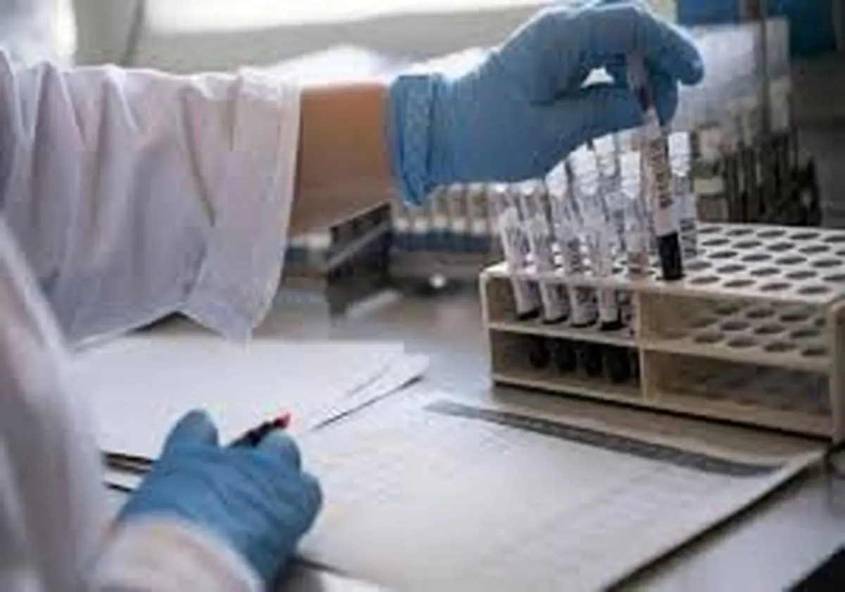 روزانه ۳۰۰ تست کرونا در کردستان انجام می‌شود