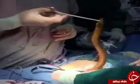 مار زنده ای که از معده انسان خارج شد!