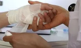 افزایش 25 درصدی مرگ و میر ناشی از سوختگی در آذربایجان شرقی