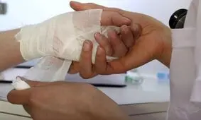 افزایش 25 درصدی مرگ و میر ناشی از سوختگی در آذربایجان شرقی