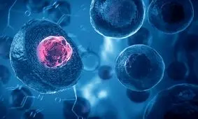 درمان یک نوزاد شش روزه با پیوند سلول‌های بنیادی