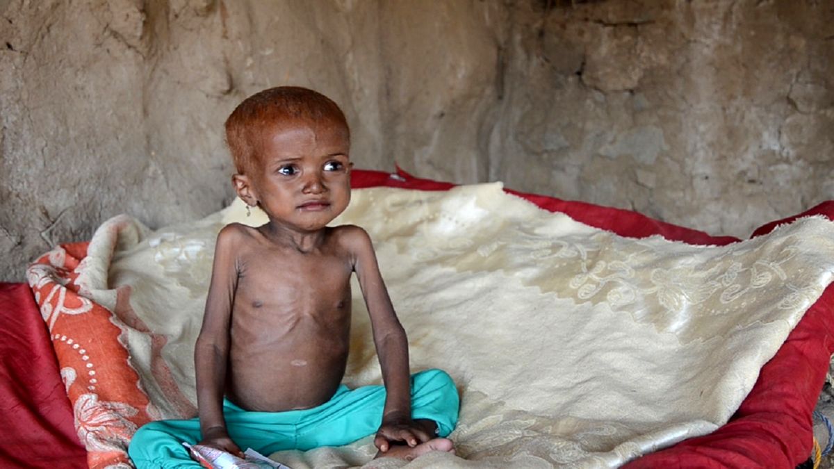 هر ۵ دقیقه، یک کودک یمنی می‌میرد