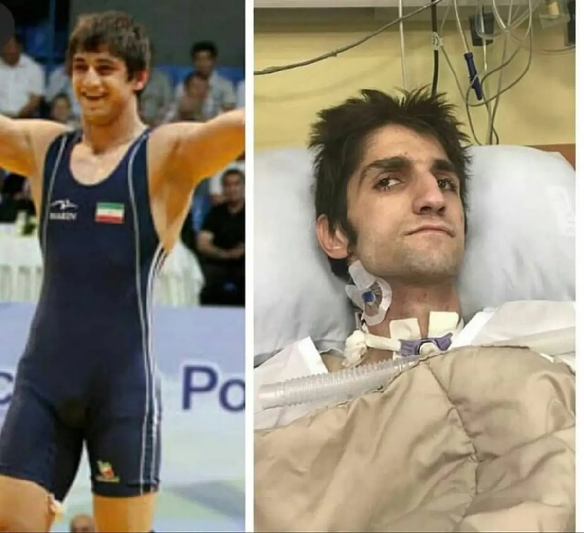 پدر قهرمان آسیا: مثل داعشی‌ها پسرم را کتک زده‌اند