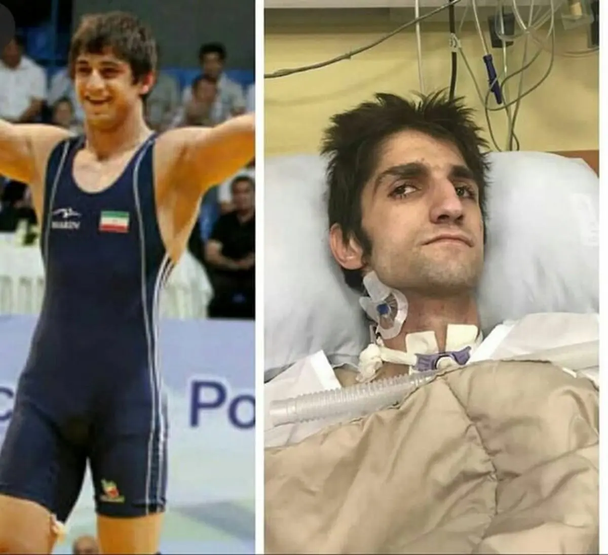 پدر قهرمان آسیا: مثل داعشی‌ها پسرم را کتک زده‌اند