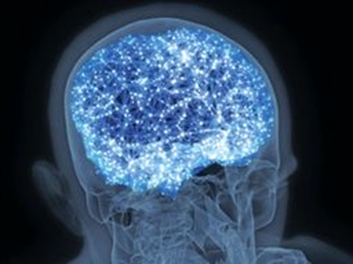 اسکن مغز عملی می‌شود؟